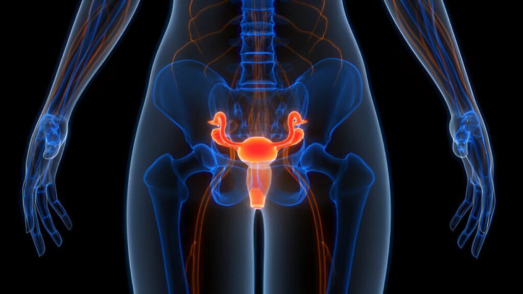 PCOD Treatment in Hyderabad | Polycystic Ovarian Disease | AMVI Hospitals